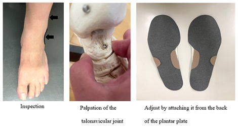 Plantar Plate Increase Upper Extremity Muscle Strength in Patients with Flat Foot