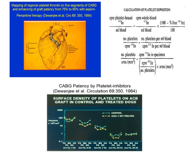 Multiple Phases of the Decline of Platelet Recruitment after Interventional Injury of Angioplasty and Coronary Artery Bypass Graft Surgery in the Animal Model