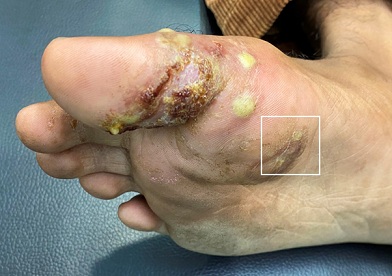Applicability of Dermoscopy in the Atypical Presentation of Tinea