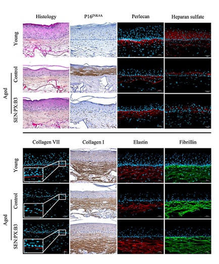 Representative images of aged-reconstructed skins treated or not with Ginkgo biloba leaf extract, Proxylane, Niacinamide