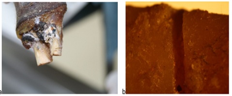 Severed radial bone (smaller bone, right) shows the ‘nick’ in the bone or false start kerf; b) Rectangular cross section of kerf floor. Image taken by a Leica LED stereomicroscope [40X].