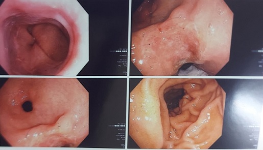 endoscopic images of gastroscopy