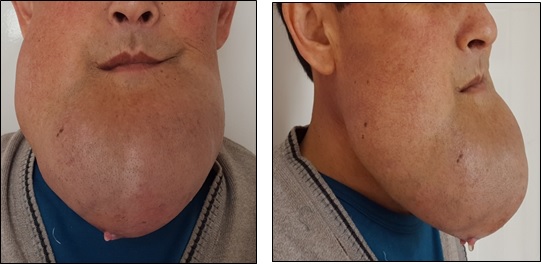 Patient before treatment. Anterior and lateral projections.