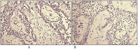 Postoperative Histology