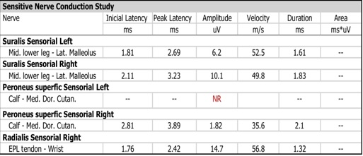 Electromyographic sensory nerve conduction study