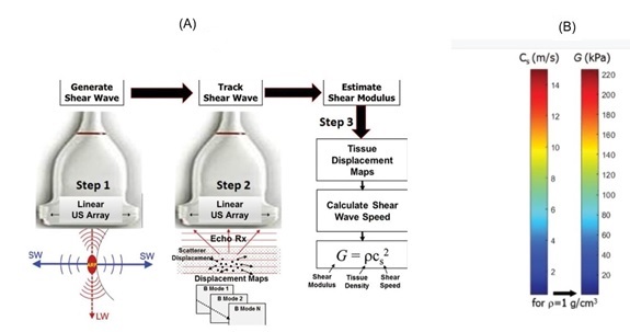 Basic physics of SWE